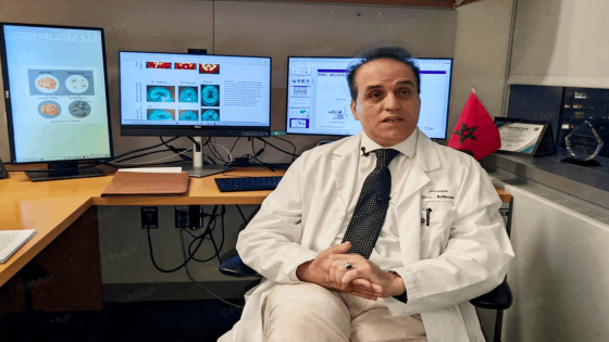 Alzheimer : des chercheurs de l’Université de New York ouvrent la voie à un dépistage précoce grâce à une simple prise de sang