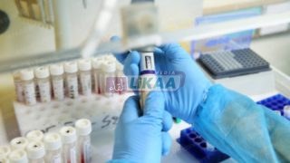 موريتانيا تتخذ إجراءات وقائية بعد تسجيل إصابة بجدري القردة في السنغال