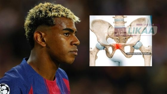 إصابة لامين يامال تبعده عن الملاعب ل 3 أسابيع