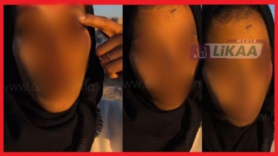 أمن أنفا يوقف شخص يشتبه في تورطه في قضية تتعلق بالضرب والجرح المفضي لعاهة مستديمة