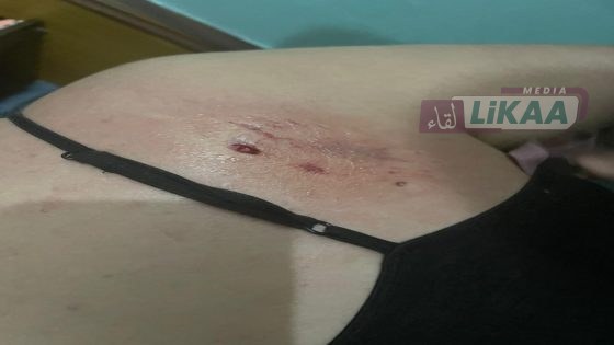 سلا.. شكاية تتهم كلباً بمهاجمة جيران وتنتهي بمقتل كلب أليف واستشفاء مالكته