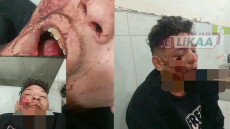 عاجل.. سيدي بنور : اتهامات بالاعتداء تطال أشخاصا يشتبه في ارتباطهم بحراسة متجر لبيع الخمور.. ومطالب بكشف الحقيقة